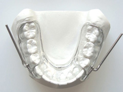 solucion de ortodoncia pul 6