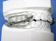 dispositivo ortodoncia pul lateral