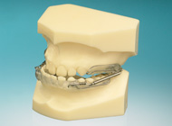 dispositivo ortodoncia pul ortoplus