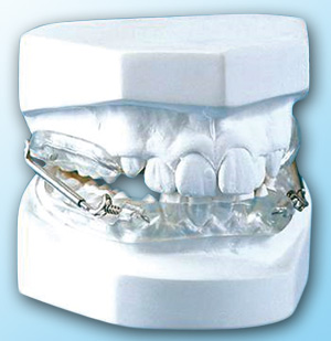 Dispositivo de avance mandibular Pul